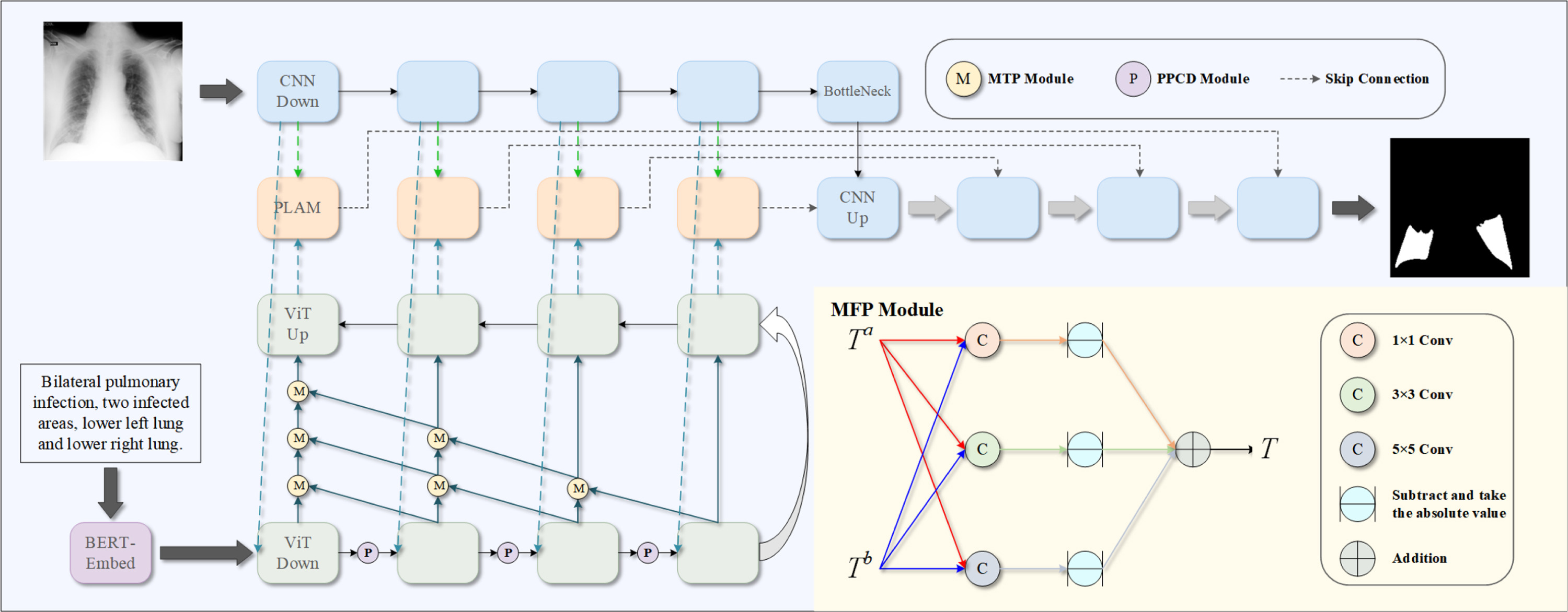 MTGT overview